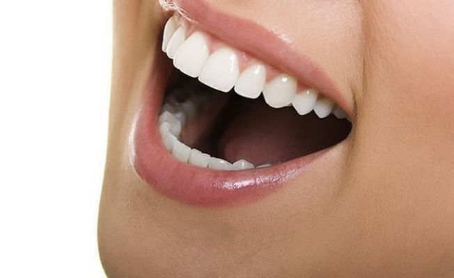 Diş teli takma korkusu lingual ortodonti ile sona eriyor
